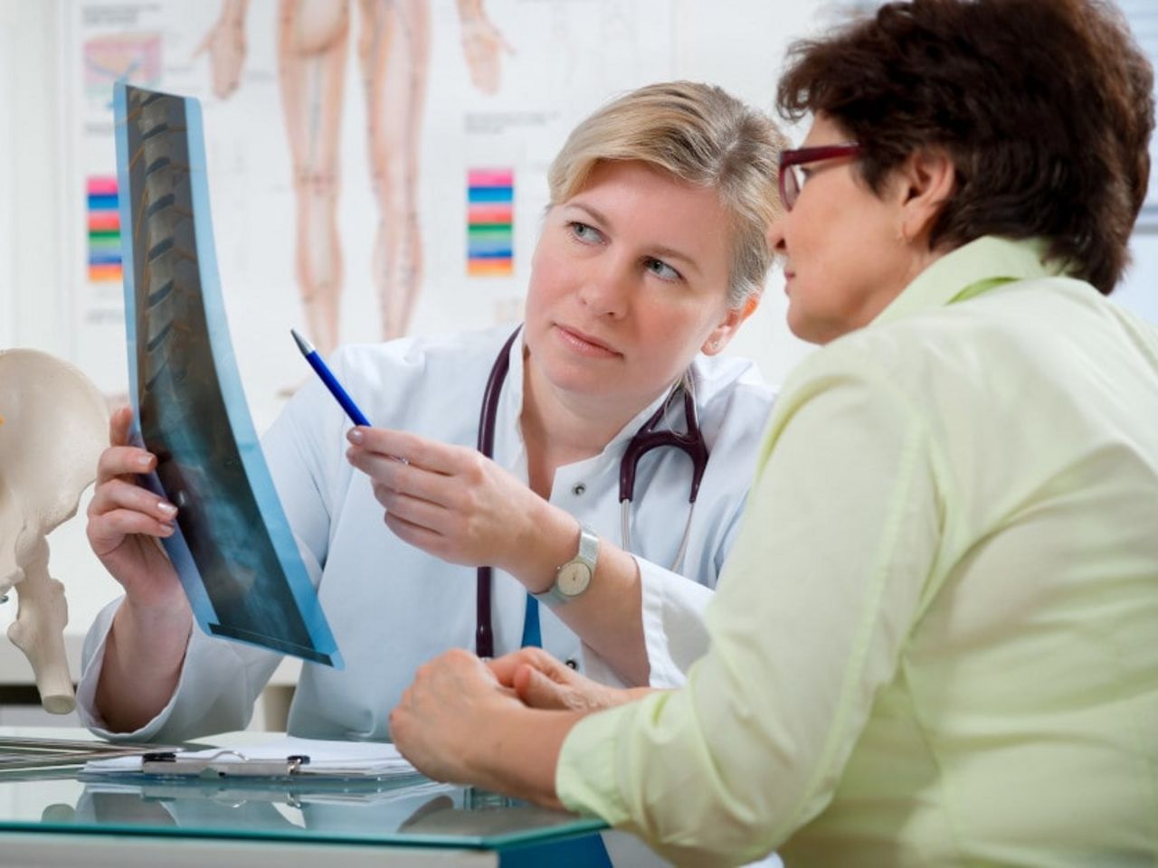 Frau zeigt Röntgenbild mit Wirbelsäulenverkrümmung